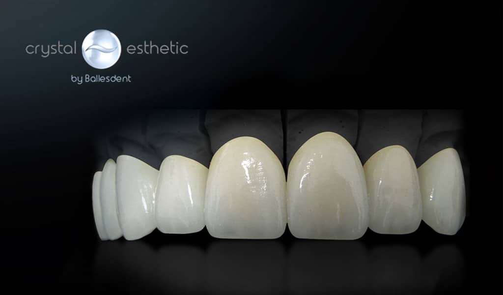 Estética dental Badalona