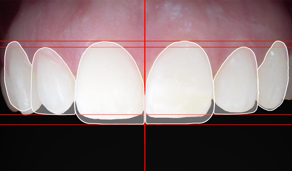 Estética dental Badalona