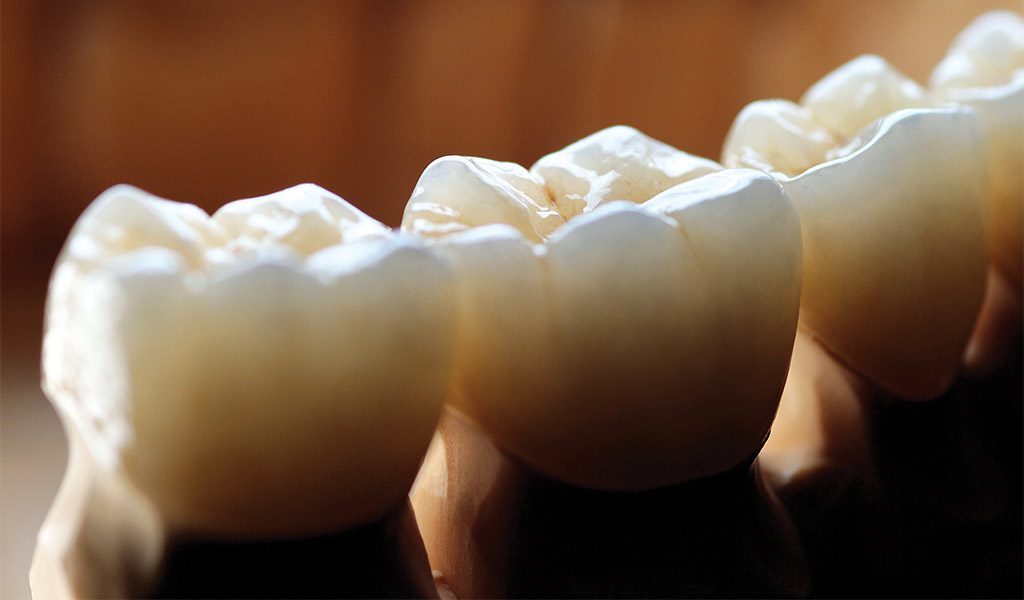Estética dental Badalona