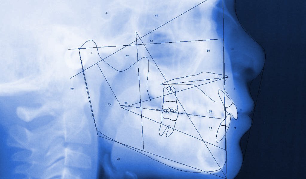 ortodoncia en Badalona