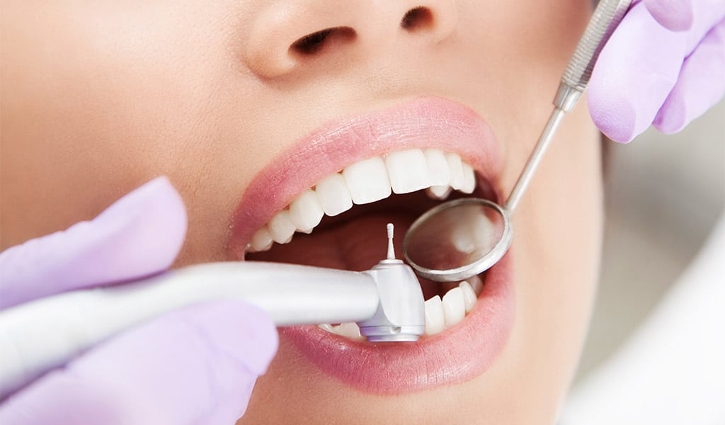 higiene dental en Badalona