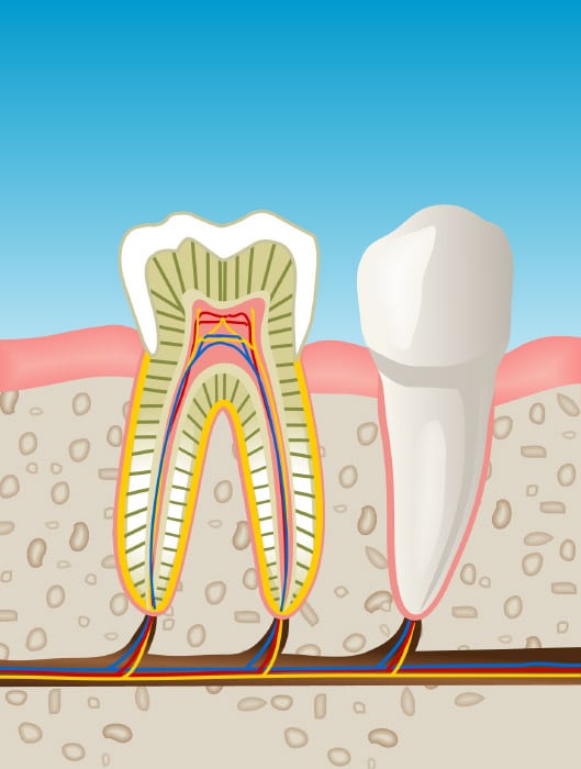 endodoncia en Badalona