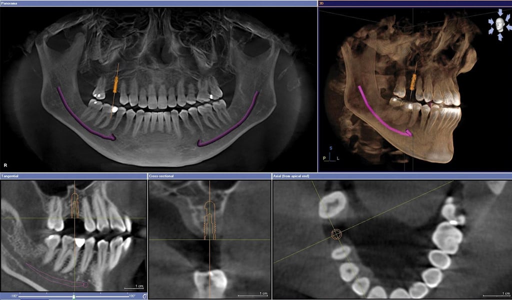 Tratamiento dental integral en Badalona