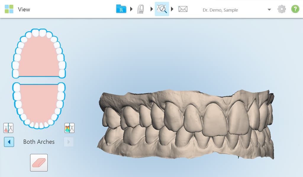 ortodoncia invisalign en Badalona