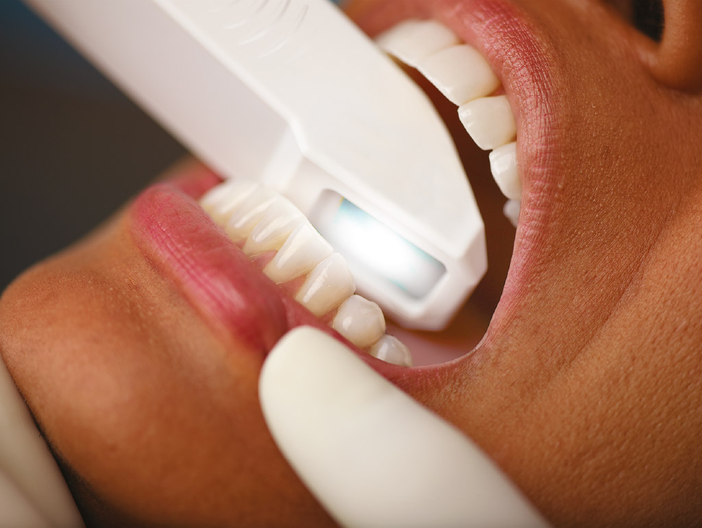 urgencias dentales en Badalona con tecnología 3D