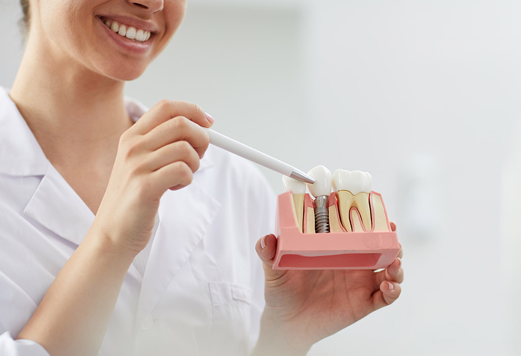 Implantes dentales de carga inmediata en Badalona