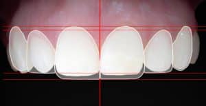 afectados de Dentix Badalona