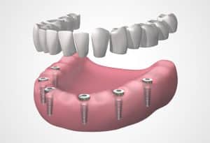 afectados de Dentix Badalona